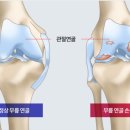 애룰바디 이미지