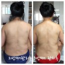 멍테라피 이미지