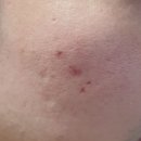 사월의봄한의원 이미지