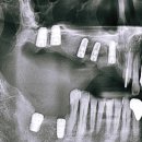강남삼성치과기공소 이미지