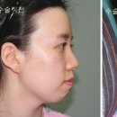 서울제일성형외과의원 이미지