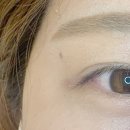 눈, 여기다 이미지