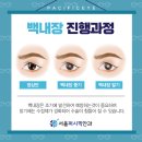 서울퍼시픽안과의원 이미지