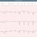 에스티메드(ST Med) | 장마감 체크사항