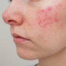 아젤리아 이미지