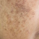 칠곡피부과의원 이미지