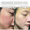 알라딘샵 | 잠실피부관리샵 추천 추러스스킨케어 알라딘필링 석촌역 여드름색소침착 후기