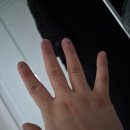 박성규 | [임신 34주]막달검사와 증상: 자연분만 대신 제왕절개 권유받은 솔직한 이유(미리안 산부인과)