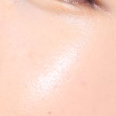 더마솔루션 이미지