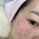 신림4번출구약국 | [신림피부관리] 지지뷰티 신대방점 -기미, 잡티, 주근깨 레이저 솔직후기