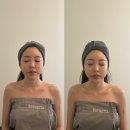씨티브이 | 해운대 웨딩 윤곽관리 잘하는 에스테티아 마린시티점 후기