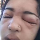 셀프피어싱 이미지