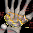 파트라슈 이미지
