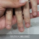 명일역 | 명일역 네일샵, 네일 손톱 모양 교정 후기