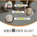레푸스MS 네이버블로그