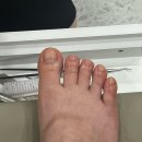 네일쏠레이
