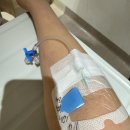 관문병원 | 난소 기형종·자궁 적출 복강경 수술 후기｜이대서울병원 입원부터 회복 7일차까지