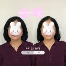 6556 | 엄마 관리시켜줌, 살이 아니라 '막힘'이었다고? 넘 충격..스페이스뷰티 신림중앙점 후기