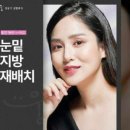 정웅기성형외과의원 네이버블로그