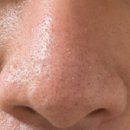 진성레이져 이미지