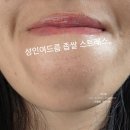 필화장품 - 평택시 경기대로 1842 | 성인 여드름화장품 피지연화제 밀킨 제스너필 에센스 좁쌀 관리 후기