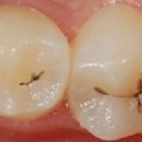 찬치과기공소 이미지