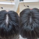 페인팅 두피 커버링으로 탈모 커버하세요!가격, 시술 시간, 유지기간 아산 미용실 고객님 찐 후기있어요!