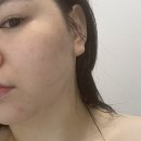 노브랜드 김해진영점 | 김해 진영 다르스킨케어 셀린브리티 약초필 후기✨ 피부톤 정리 제대로!