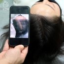 프로스칼프부산 이미지