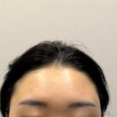 조헤어라인 이미지