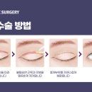 오르성형외과의원 이미지