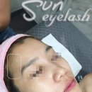 썬헤어라인 이미지