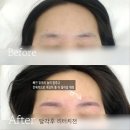 경산 여자눈썹 자연스럽게 잘하는 ! 뷰티윤 추천 ! 콤보눈썹 후기