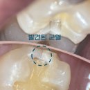 곽정원현미경치과의원 | [공지] 곽정원현미경치과의원을 알게 되신 분들께..