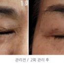 설레임 에스테틱