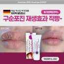 독일약국 이미지