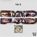 천안 애견치과전문 동물병원 불당동 “닥터스” 치아발치 후기