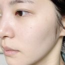 아드망 | 피부노화방지 안티에이징 로션 추천, 손상된 피부장벽개선 아드망 항당화 로션 사용후기