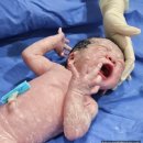스타메디케어 | [출산] 분당제일여성병원 37주 제왕절개 후기1 - 생각보다 괜찮았던, 신생아 빈호흡 증후군