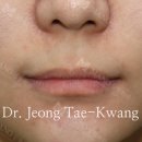인중 이미지