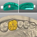 지르스타치과기공소 이미지