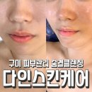 주향유치원 | 구미 형곡동 피부관리 다인스킨케어 숨결클렌징으로 피부개선 제대로
