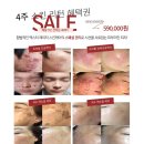 아리나뷰티케어 네이버블로그