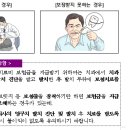 보험가입 이후 치과의사의 발치 진단에 따라 영구치를 발치한 후 보철치료를 받아야 보험금을 받을 수 있습니다 이미지