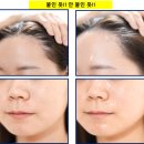 아이레 이미지