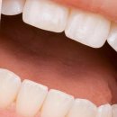 나눔이치과의원 이미지