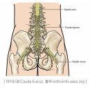 엉덩방아후 찾아오는 척추 통증 이미지