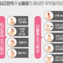 뇌경색 뇌졸증 초기 전조증상 원인 이미지