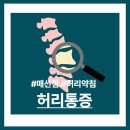동대문한의원 | 동대문한의원, 허리디스크는 디스크의 문제가 아니라 버티는 힘의 문제였습니다.