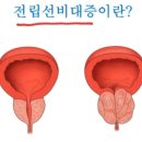 전립선비대증 이미지